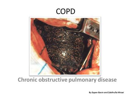 COPD Chronic obstructive pulmonary disease By Espen Gavin and Zabihulla Mirzai.