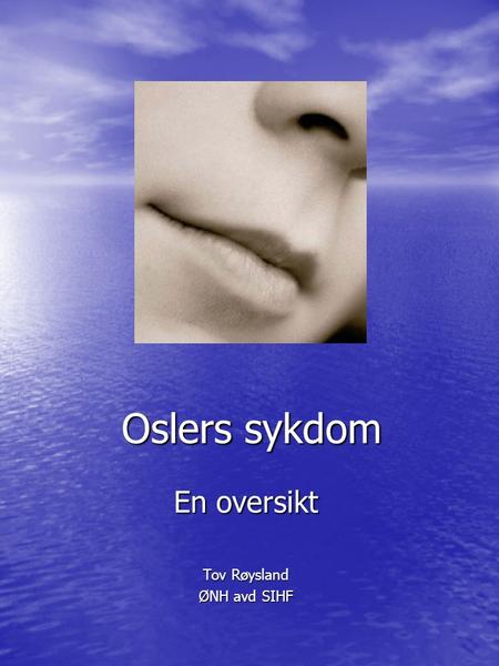 Oslers sykdom En oversikt Tov Røysland ØNH avd SIHF.