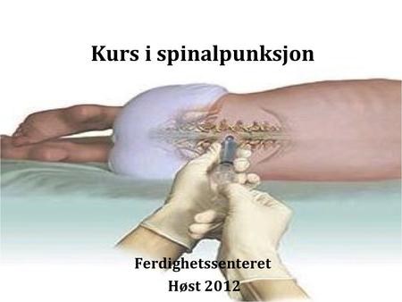 Kurs i spinalpunksjon Ferdighetssenteret Høst 2012.
