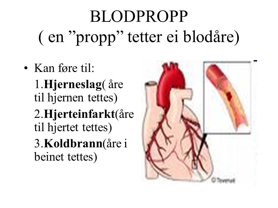 BLODPROPP ( en propp tetter ei blodåre)