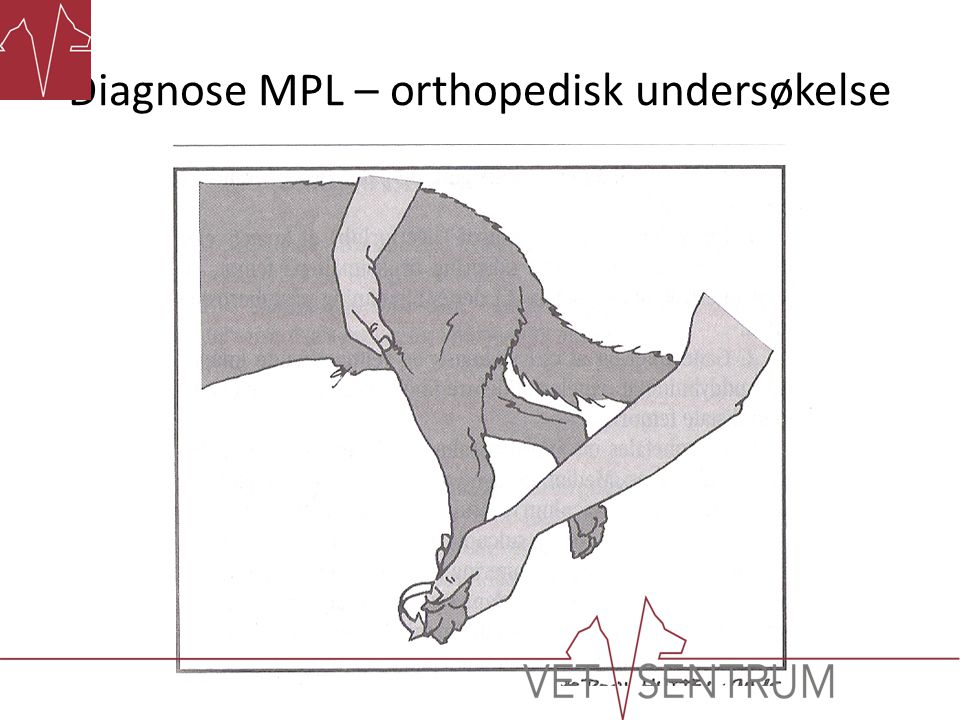 Diagnose MPL – orthopedisk undersøkelse