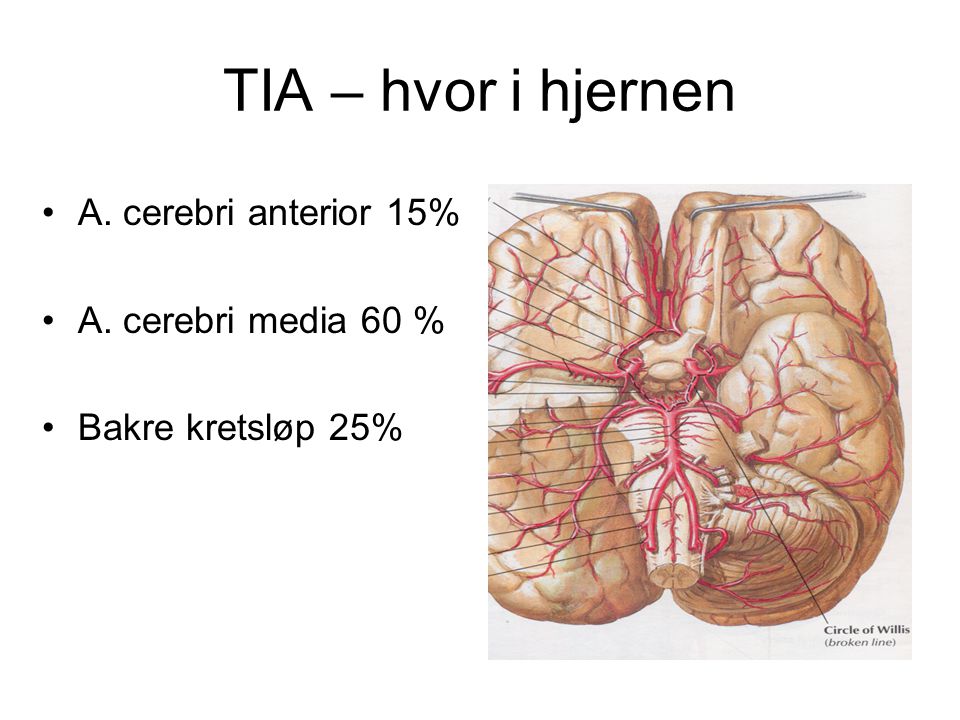 TIA – hvor i hjernen A. cerebri anterior 15% A. cerebri media 60 %