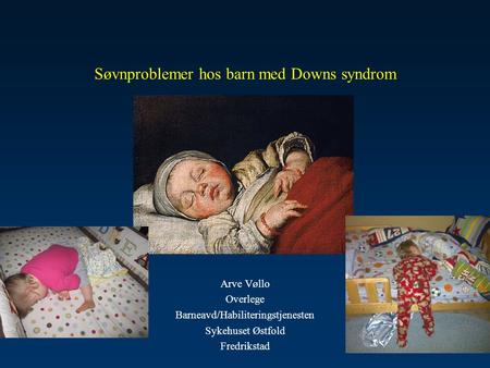 Søvnproblemer hos barn med Downs syndrom