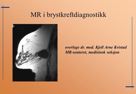 MR i brystkreftdiagnostikk