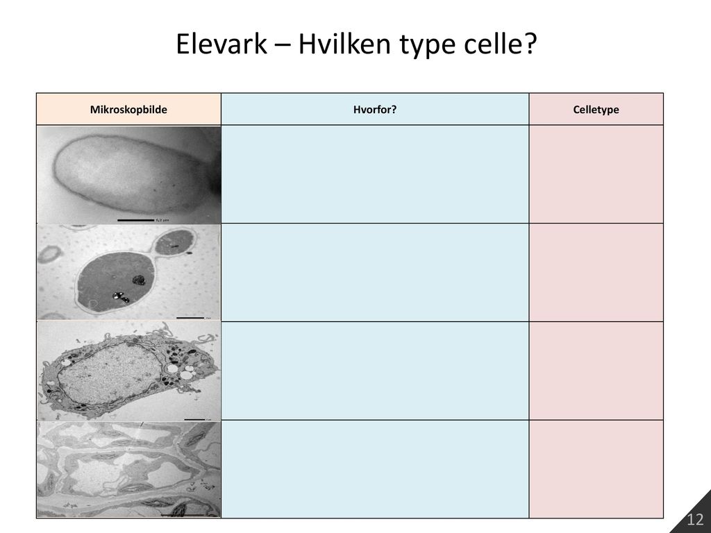 Elevark – Hvilken type celle
