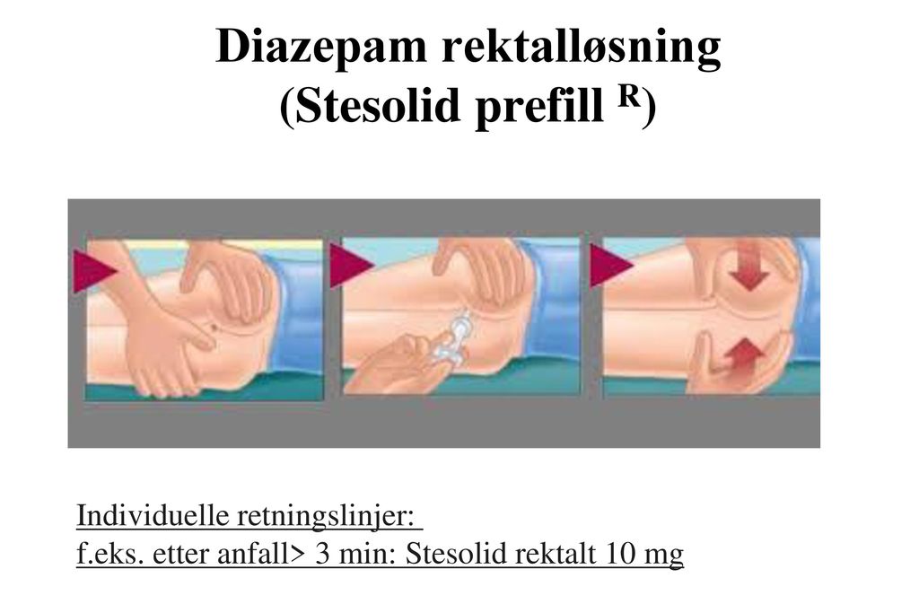Diazepam rektalløsning (Stesolid prefill R)
