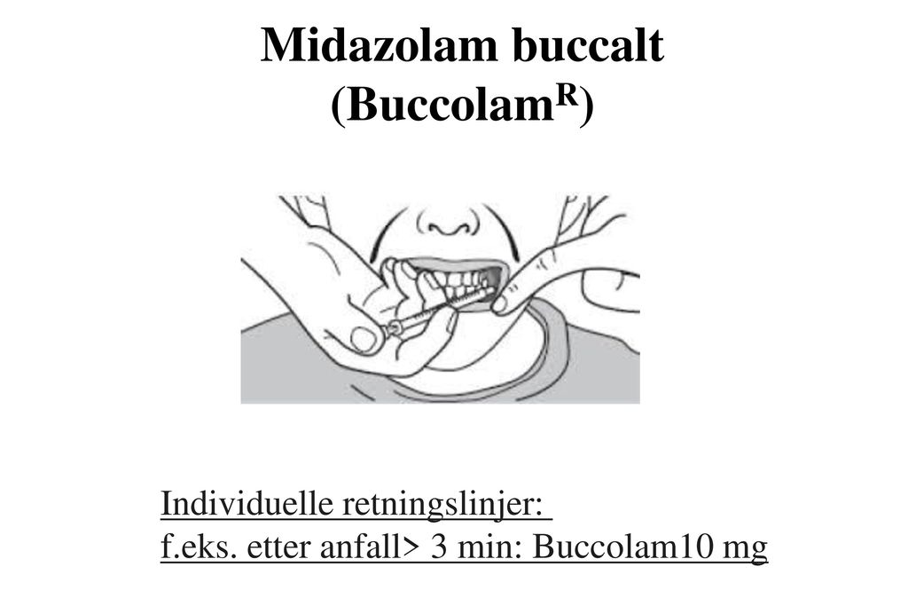 Midazolam buccalt (BuccolamR)