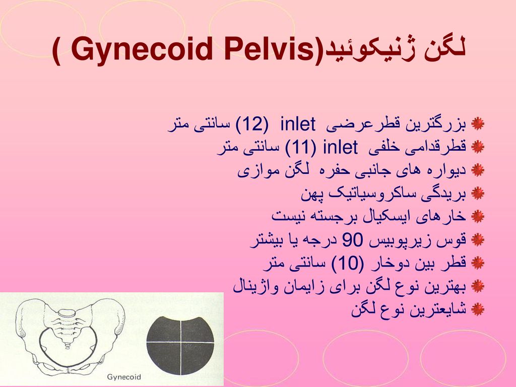 لگن ژنیکوئید(Gynecoid Pelvis )