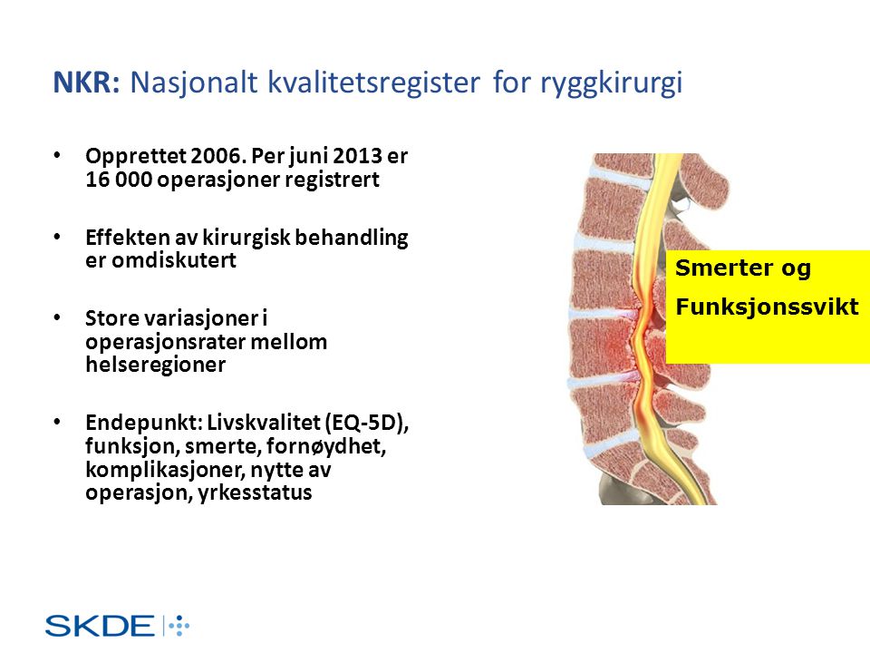 NKR: Nasjonalt kvalitetsregister for ryggkirurgi