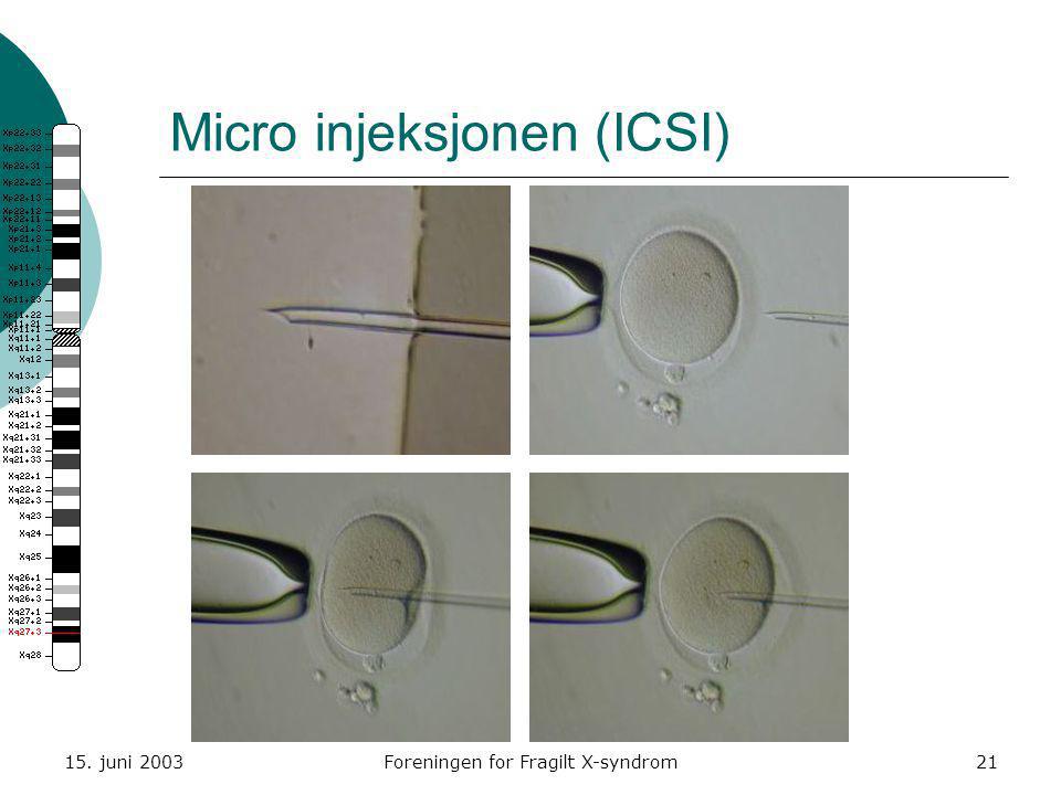 Micro injeksjonen (ICSI)