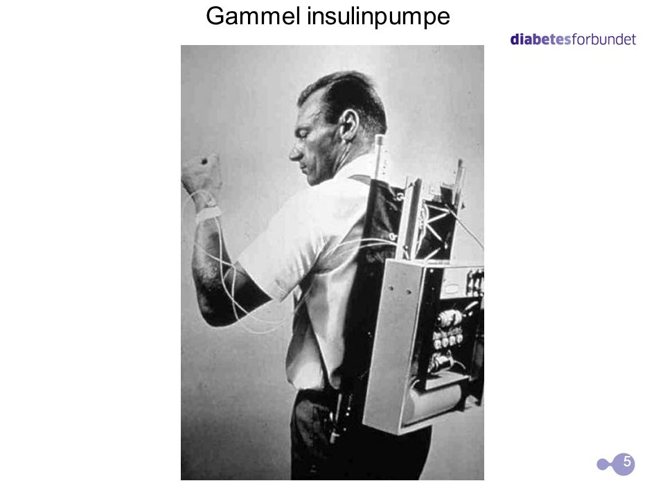 Gammel insulinpumpe 5 5