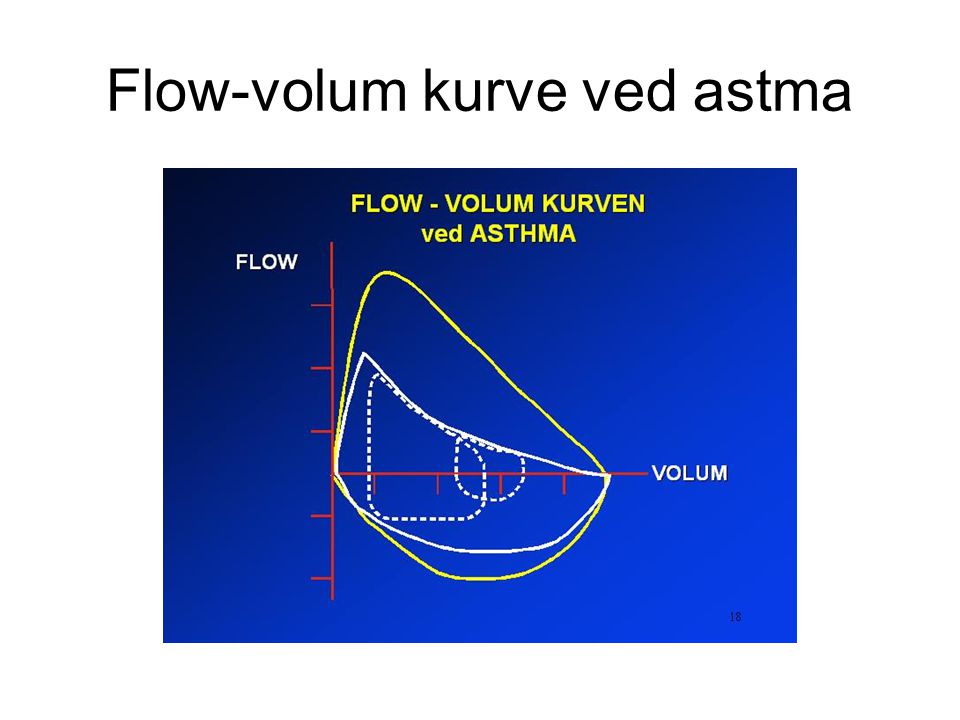 Flow-volum kurve ved astma
