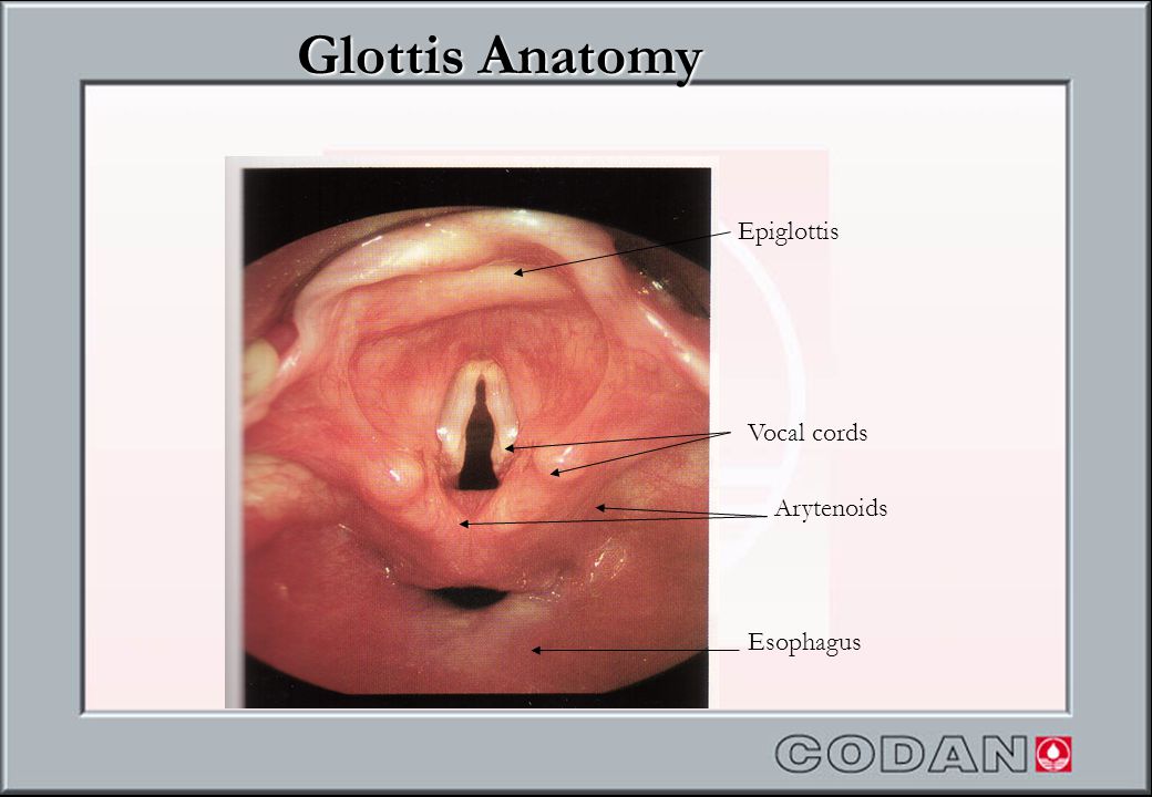 Glottis Anatomy Epiglottis Vocal cords Arytenoids Esophagus