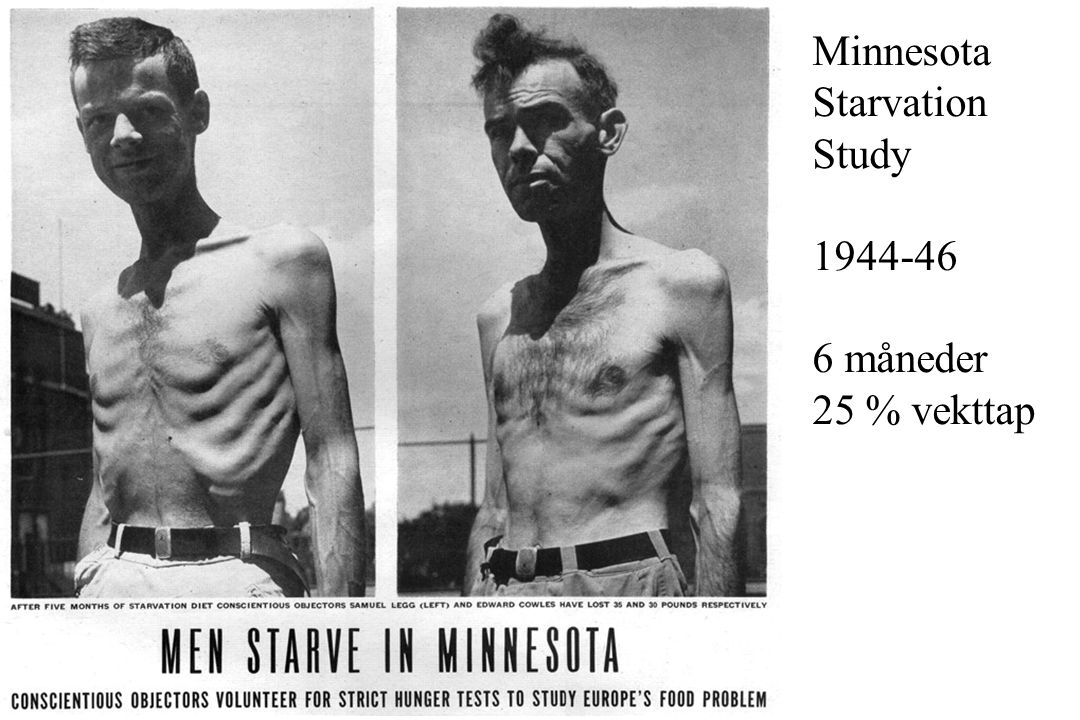 Minnesota Starvation Study måneder 25 % vekttap