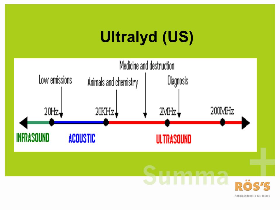 Ultralyd (US)