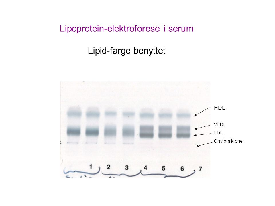 Lipoprotein-elektroforese i serum