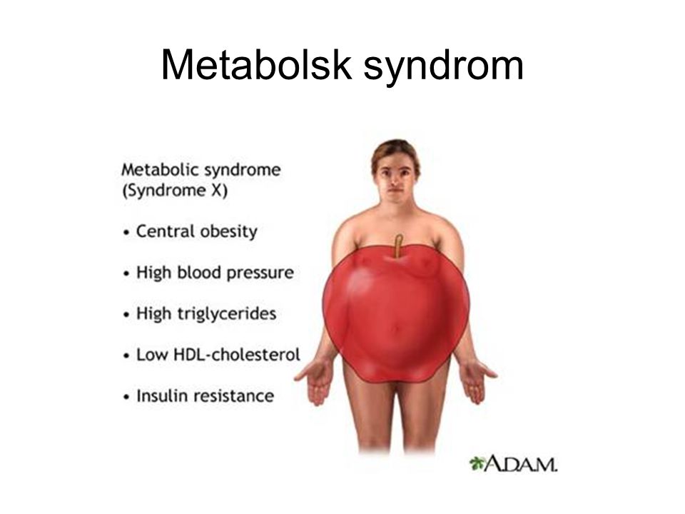 Metabolsk syndrom