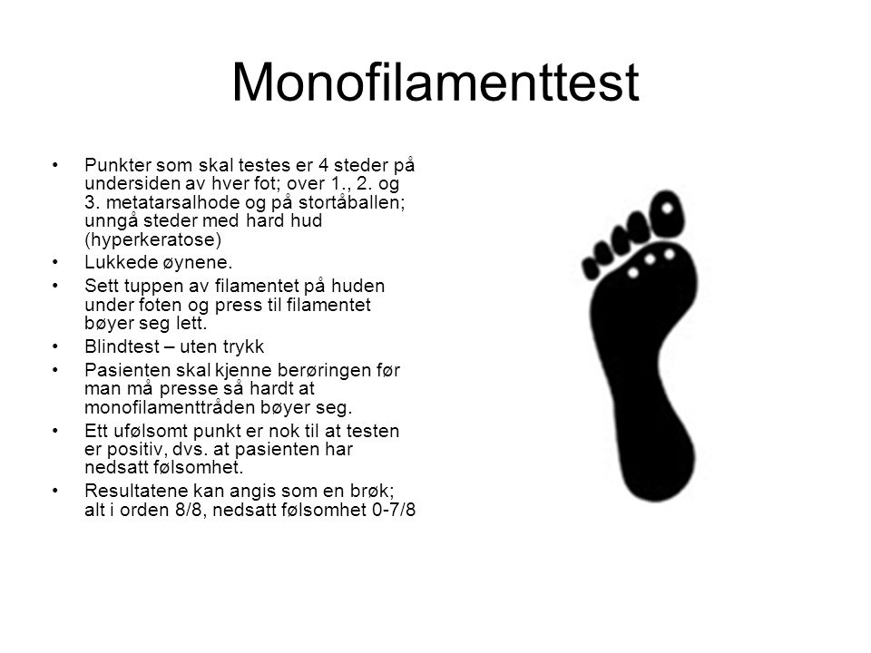 Monofilamenttest