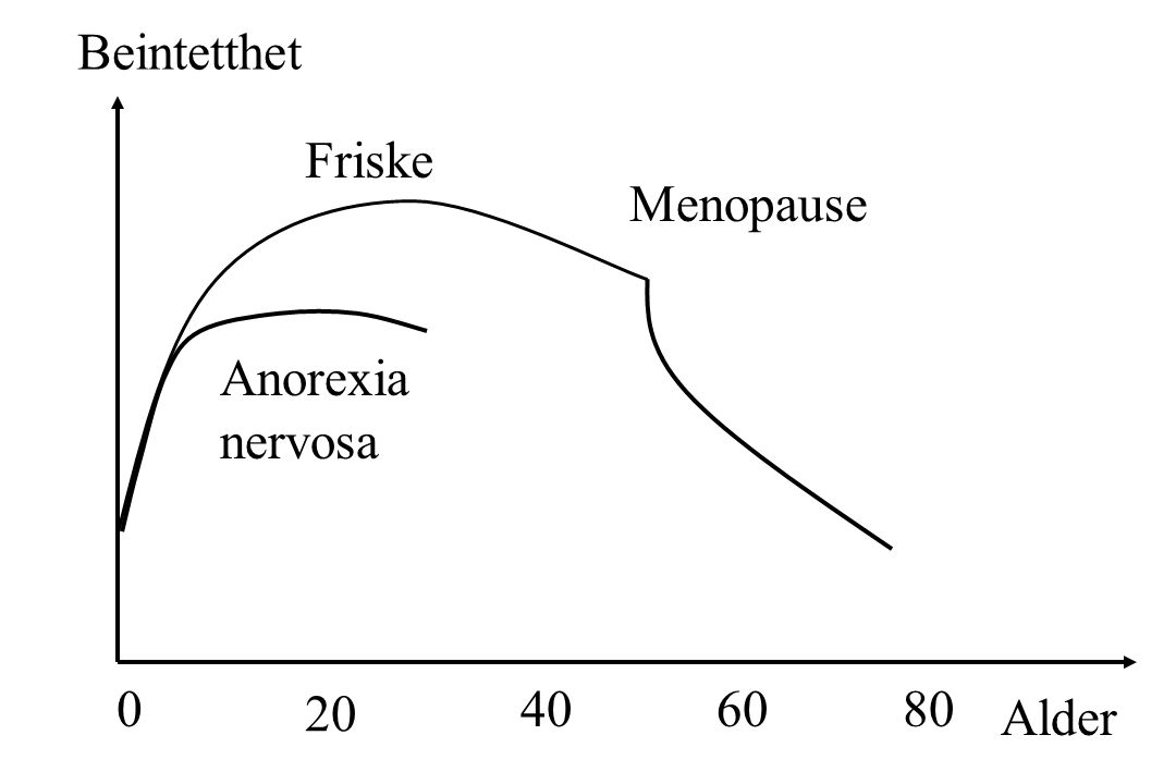 Beintetthet Friske Menopause Anorexia nervosa Alder