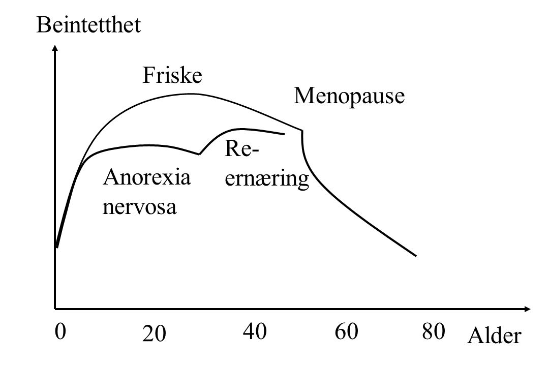 Beintetthet Friske Menopause Re- ernæring Anorexia nervosa Alder