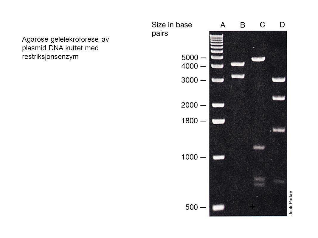 Agarose gelelekroforese av plasmid DNA kuttet med restriksjonsenzym