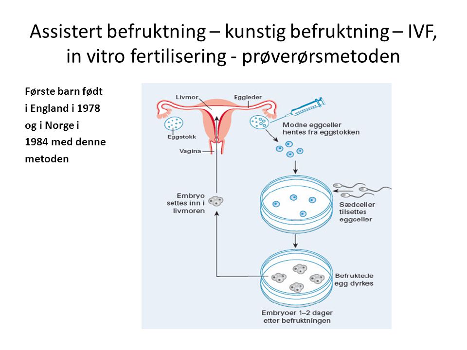 Assistert befruktning – kunstig befruktning – IVF, in vitro fertilisering - prøverørsmetoden