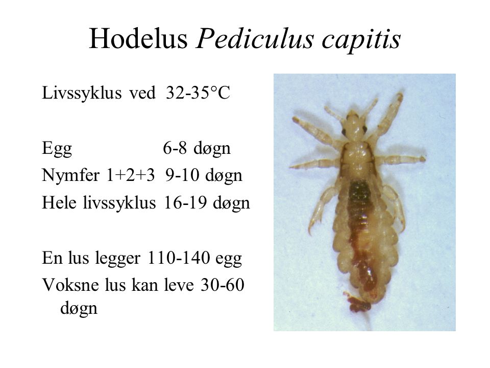 Hodelus Pediculus capitis