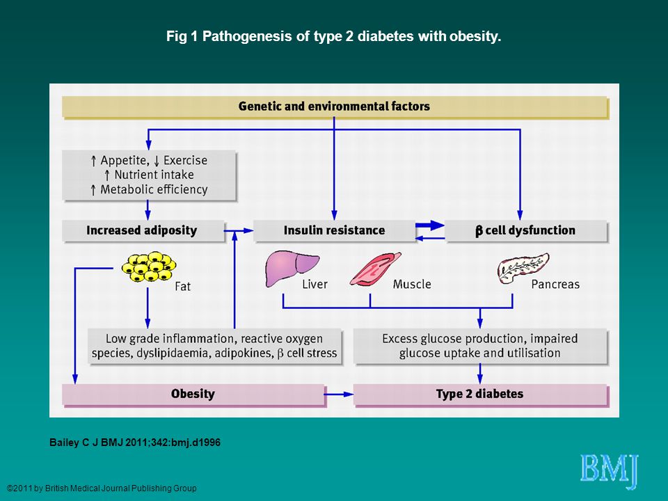 Fig 1 Pathogenesis of type 2 diabetes with obesity.