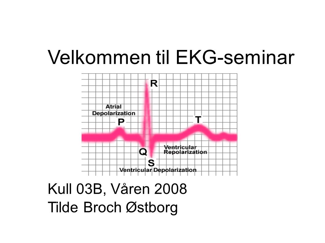 Velkommen til EKG-seminar