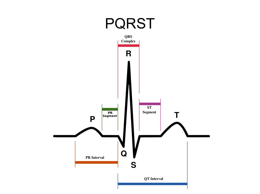 PQRST Det går strøm ved depolarisering og ved repolarisering.