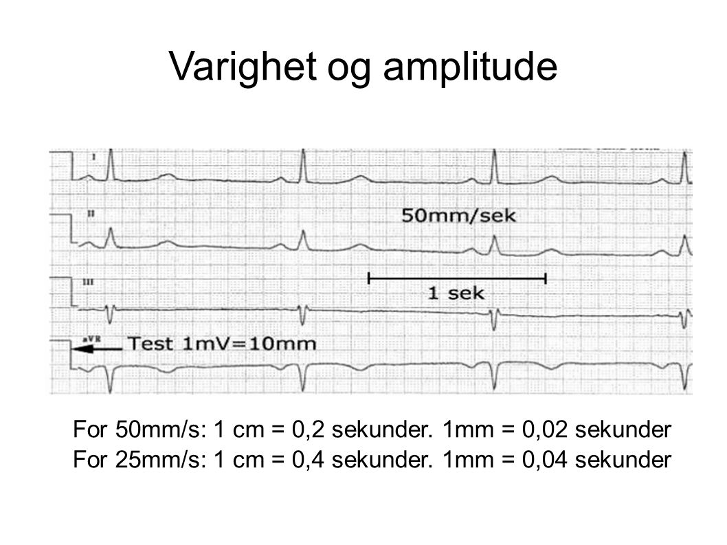 Varighet og amplitude 25 mm vs. 50 mm. Absolutt vanligst med 50 mm på sykehus: MEN sjekk alltid papirhastigheten.