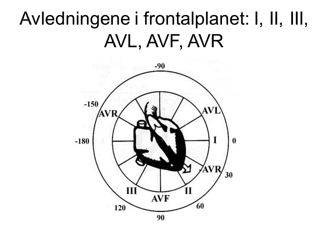 Avledningene i frontalplanet: I, II, III, AVL, AVF, AVR