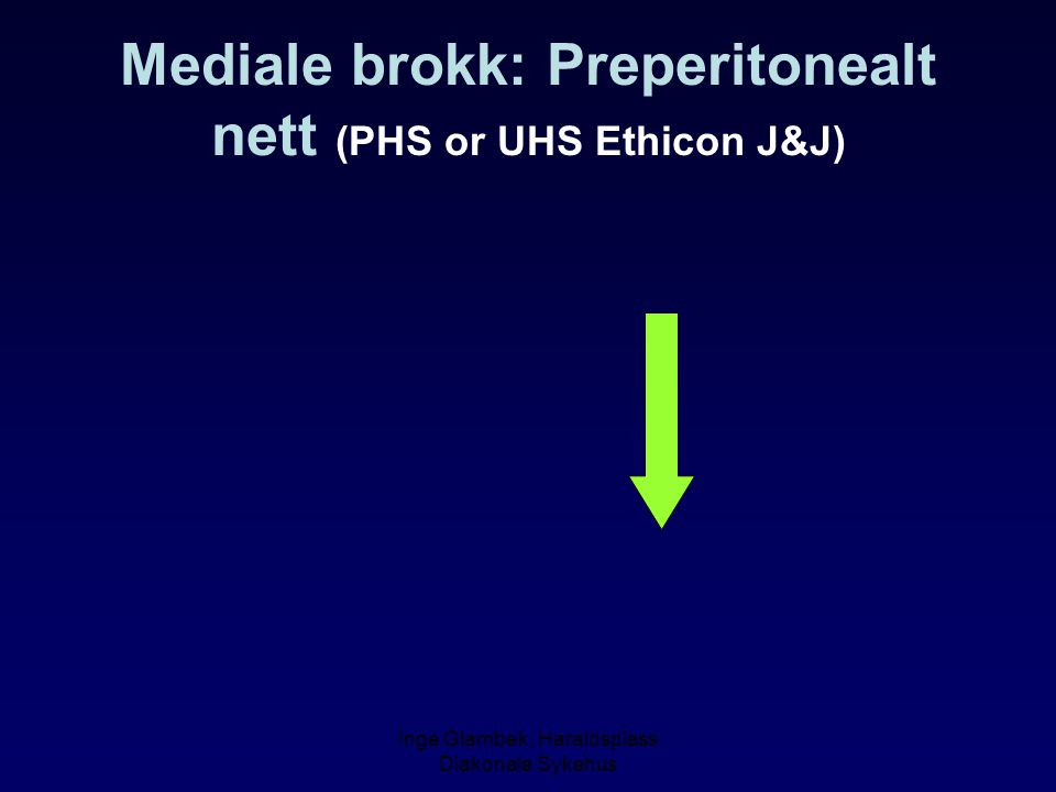 Mediale brokk: Preperitonealt nett (PHS or UHS Ethicon J&J)