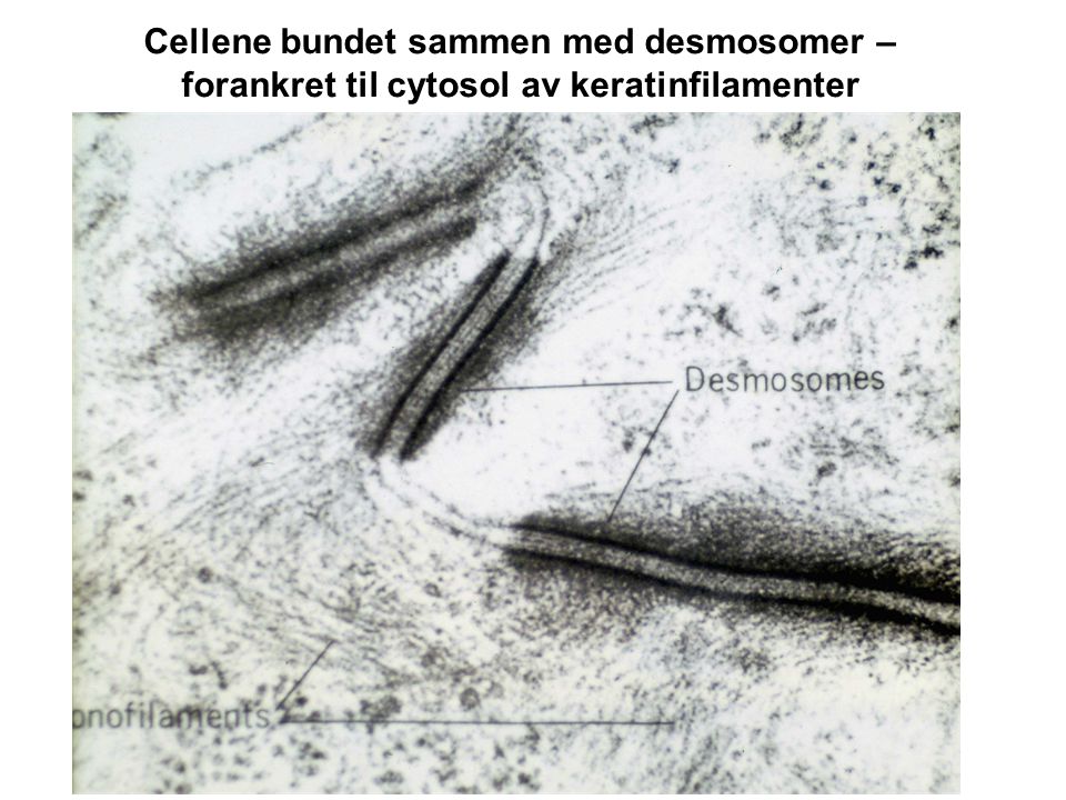 Cellene bundet sammen med desmosomer – forankret til cytosol av keratinfilamenter