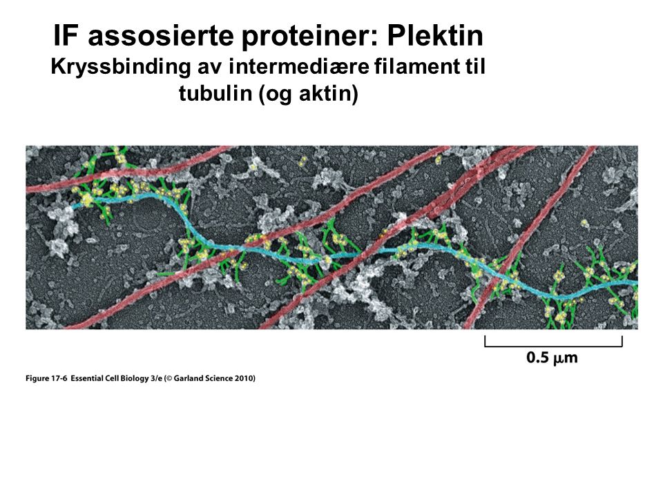 IF assosierte proteiner: Plektin Kryssbinding av intermediære filament til tubulin (og aktin)