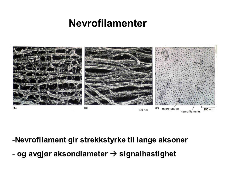 Nevrofilamenter Nevrofilament gir strekkstyrke til lange aksoner
