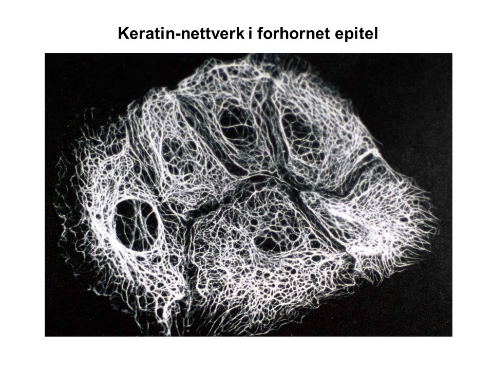Keratin-nettverk i forhornet epitel