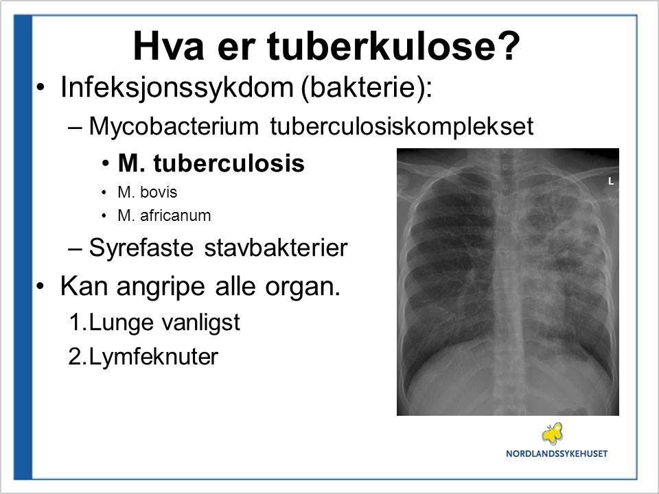 Hva er tuberkulose Infeksjonssykdom (bakterie):