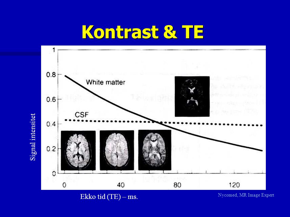 Kontrast & TE Signal intensitet Ekko tid (TE) – ms.