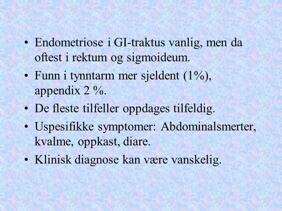 Endometriose i GI-traktus vanlig, men da oftest i rektum og sigmoideum.