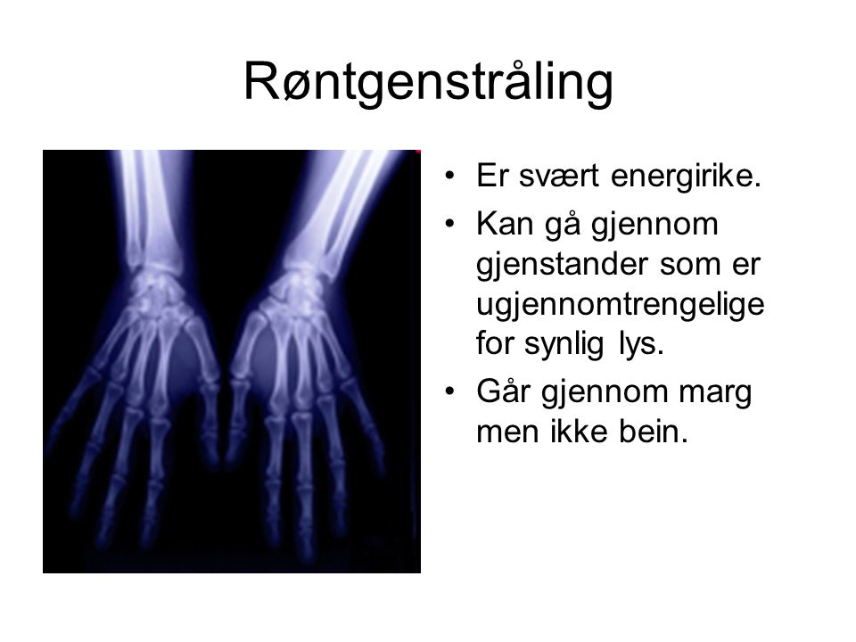 Røntgenstråling Er svært energirike.