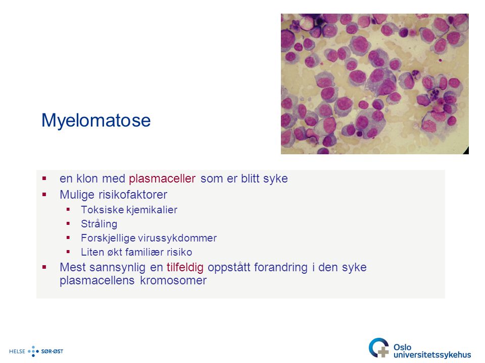 Myelomatose en klon med plasmaceller som er blitt syke