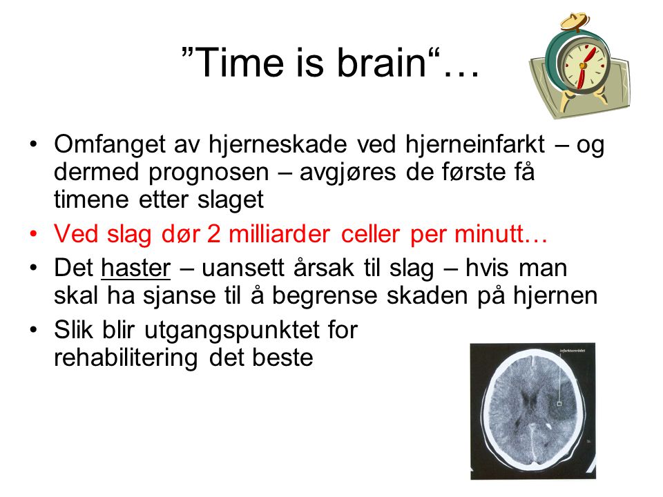 Time is brain … Omfanget av hjerneskade ved hjerneinfarkt – og dermed prognosen – avgjøres de første få timene etter slaget.