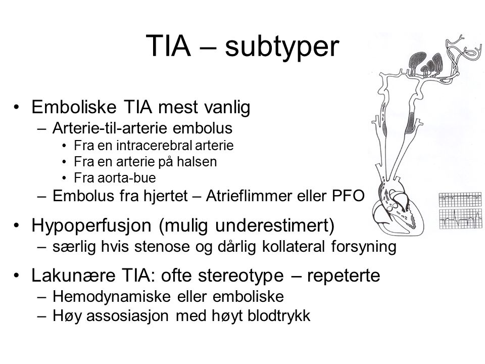 TIA – subtyper Emboliske TIA mest vanlig