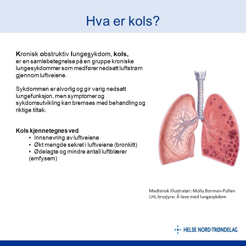 Hva er kols Kronisk obstruktiv lungesykdom, kols,