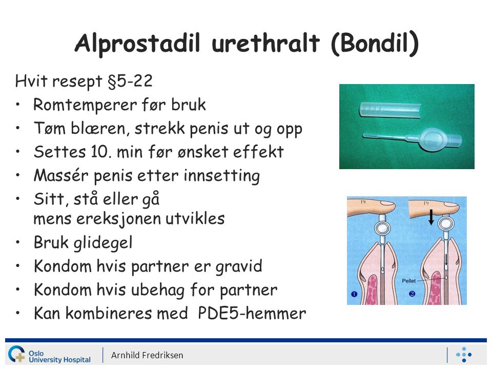 Alprostadil urethralt (Bondil)