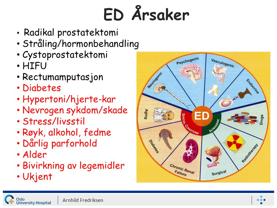 ED Årsaker Stråling/hormonbehandling Cystoprostatektomi HIFU